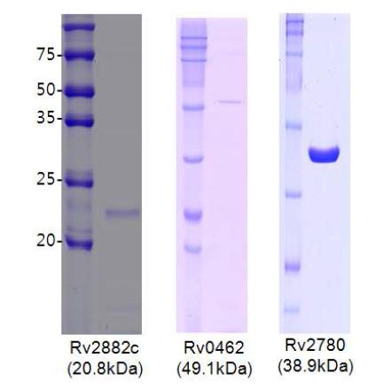 SDS-PAGE analysis of purified recombinant proteins.