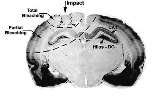 Six hours after rats underwent a weight drop TBI, obvious brain damage is shown in cerebral cortex and hippocampus.