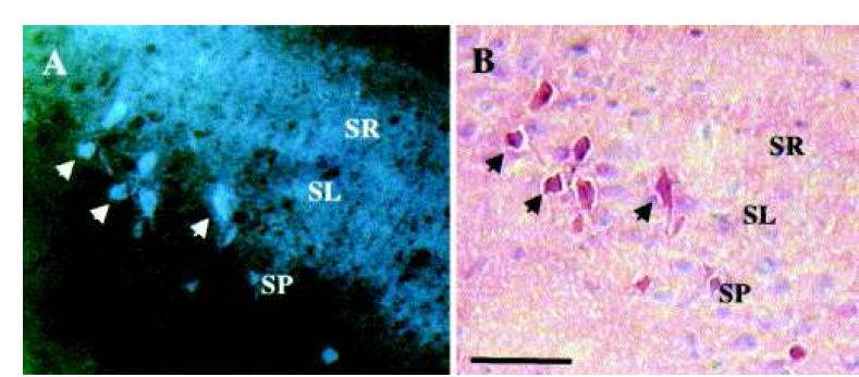 Neuronal degeneration in hippocampus can be seen 6 hour after TBI.