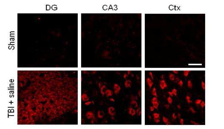 Reactive oxygen species (ROS) was detected in the hippocampus and cortex neurons 3 hours after traumatic brain injury (TBI). ROS was labeled by dehydroethidium injection (red color). Sham operation shows almost no ethidium stained neuron in the hippocampus and cortex. Scale bar represents 100 um.