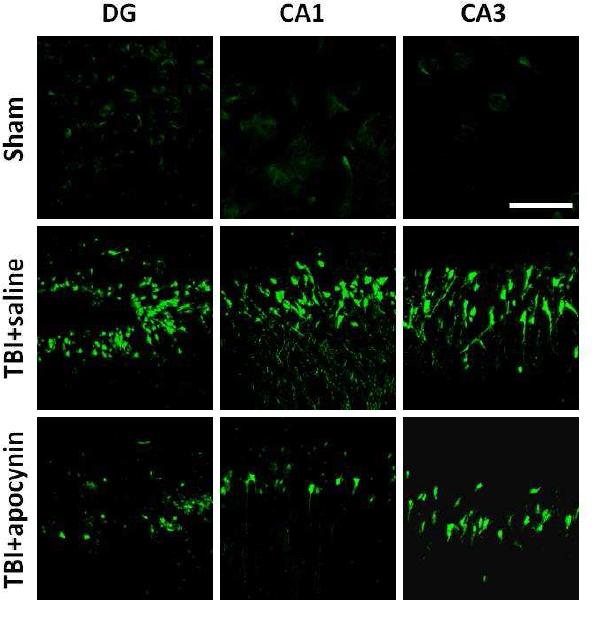 Neuronal death after TBI was prevented by apocynin treatment. Apocynin was injected into intraperitoneal space immediately after TBI. 24 hours after brains were harvested and sections were stained with Fluoro Jade-B for detecting neuronal death. Fluorescent images show degenerating neurons in the hippocampus DG, CA1 and CA3 area. Scale bar = 100 m.