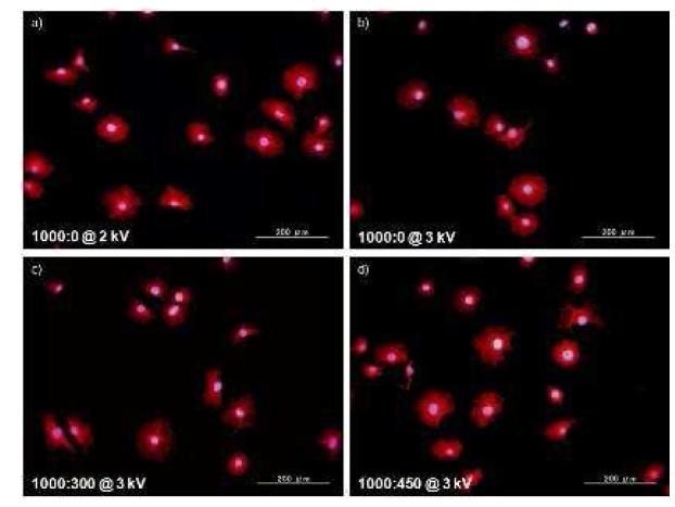 서로 다른 가스 조성 및 방전 전압으로 planar DBD type 플라즈마 처리된 티타늄에 대한 MC3T3-E1 cell의 형광 현미경 사진