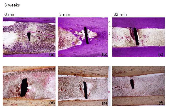 티타늄 샘플을 정강뼈에 이식 3주 후, isolation 시켜 H&E staining, von kossa staining을 통해 조직 변화, 칼슘 침착을 관찰