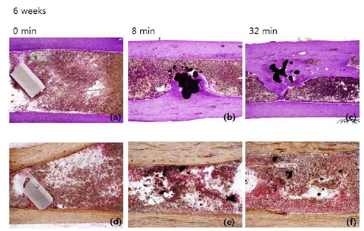 티타늄 샘플을 정강뼈에 이식 6주 후, isolation 시켜 H&E staining, von kossa staining을 통해 조직 변화, 칼슘 침착을 관찰