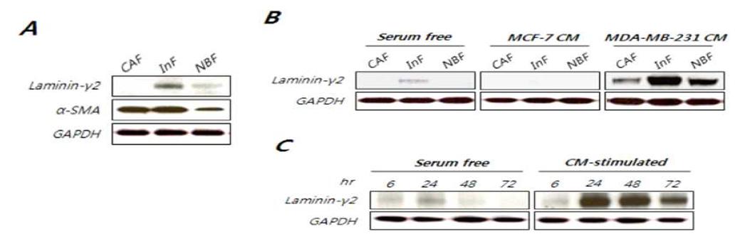 종양세포 침윤성에 따른 섬유아세포의 laminin-γ2 발현 변화.