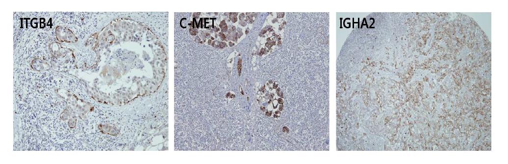 유방암 임파선 전이인자의 조직내 ITGB4, c-MET, IGHA2 검증