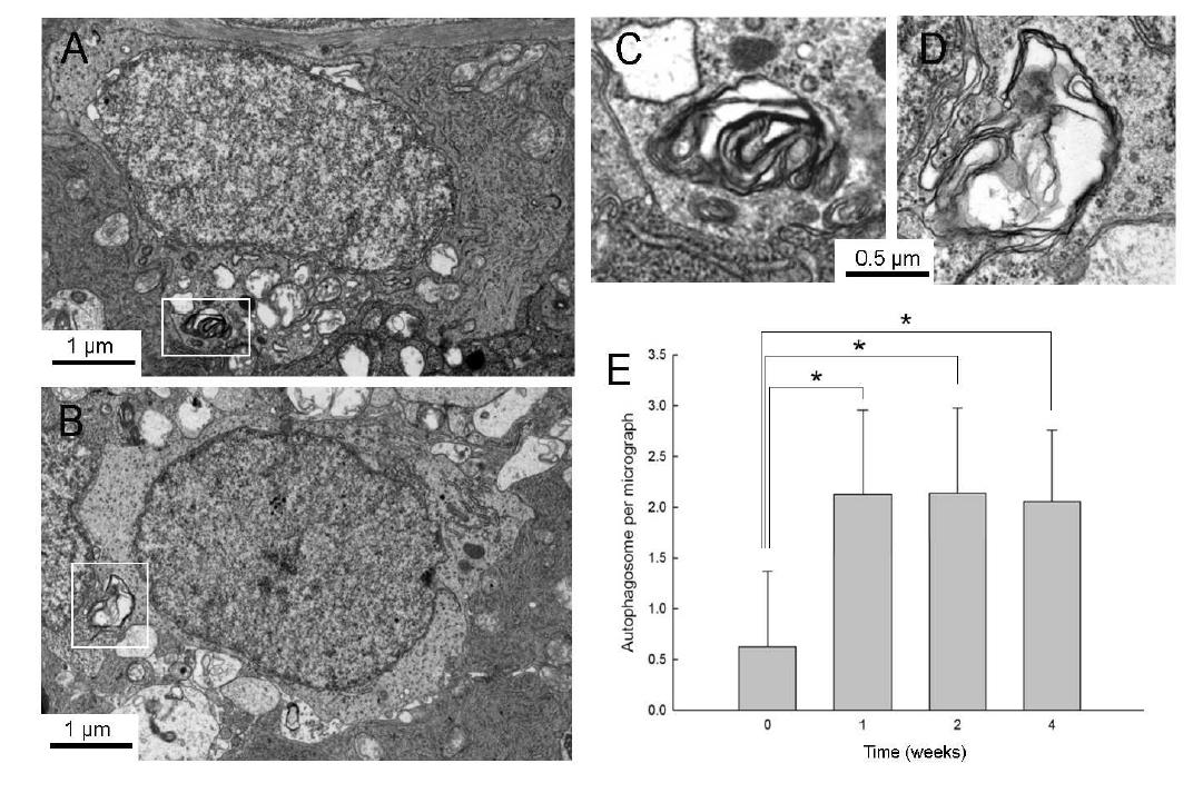 Figure 2. Transmission electron micrographs of retinal ganglion cells (RGCs) in the ganglion cell layer(GCL).