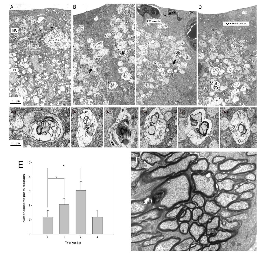 Figure 3. Transmission electron micrographs of dendrites in the inner plexiform layer(IPL).