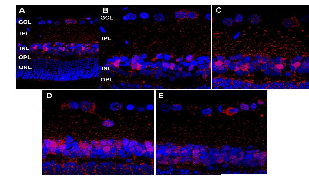 Figure 5. Time course of LC3B immunoreactivity revealed by confocal microscopy after cauterization.