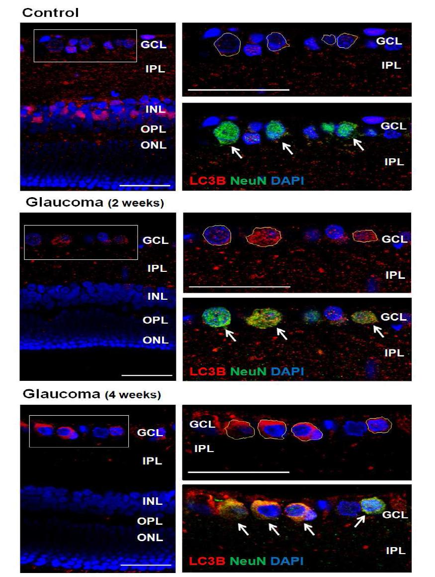 Figure 6. Confocal micrographs of double labeled LC3B and NeuN as a ganglion cell marker(Top).