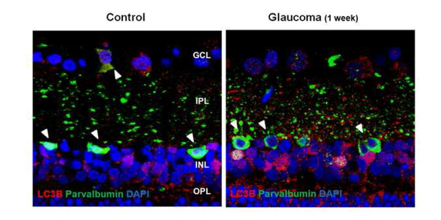 Figure 7. Confocal micrographs of double labeled LC3B and parvalbumin as an amacrine cell marker.