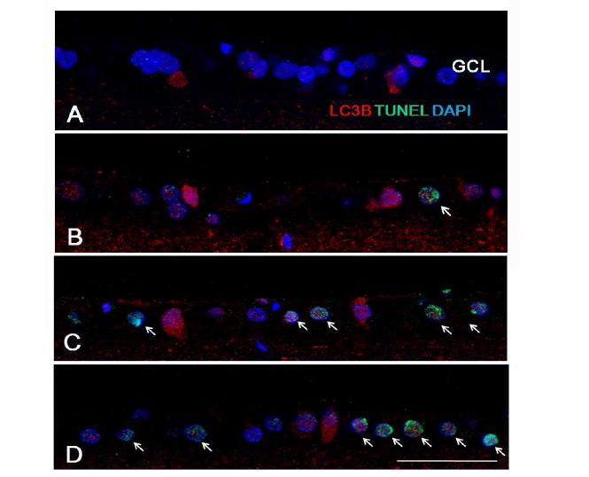 Figure 8. Confocal micrographs of double labeled LC3B and terminal deoxynucleotidyl transferase-mediated dUTP-nick end-labeling (TUNEL) staining.