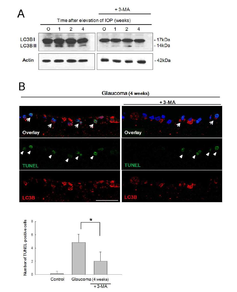 Figure 10. After treatment with 3-methyladenine (3-MA).