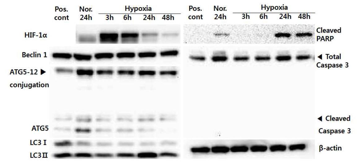 저산소증에서 배양한 구강편평세포암종 세포주에서 autophagy와 apoptosis related protein의 발현 변화