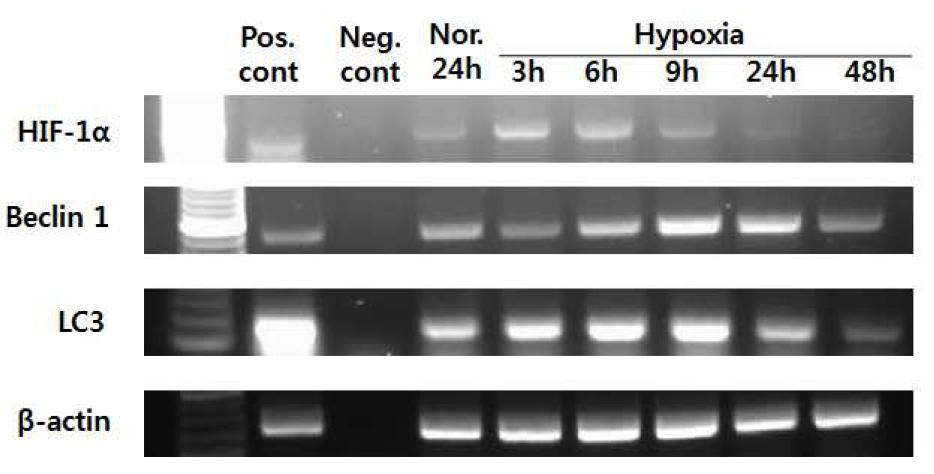 저산소증에서 배양한 구강편평세포암종 세포주에서 autophagy와 apoptosis related gene의 발현 변화