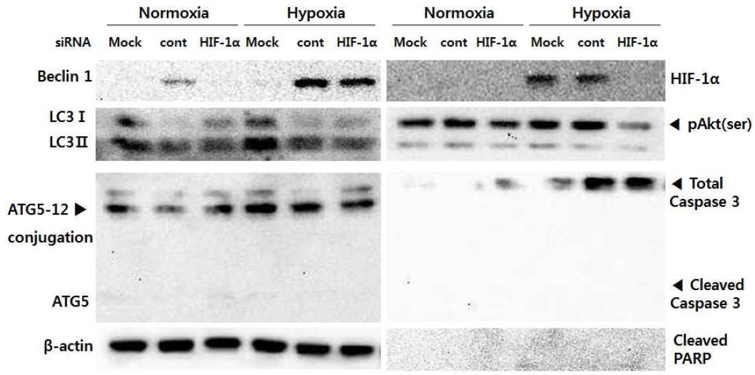 Beclin 1 siRNA를 처리했을 경우 구강편평세포암종 세포주에서 autophagy와 apoptosis related protein의 발현 변화