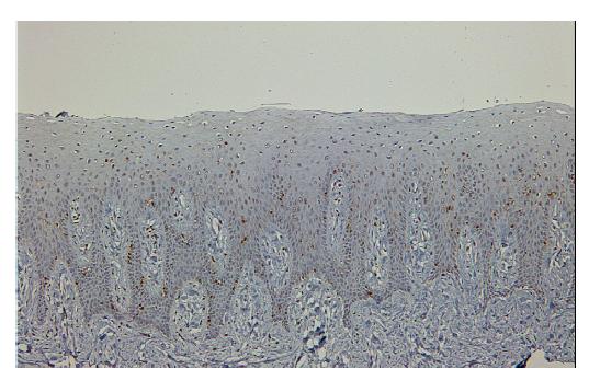 The expression of RUNX3 in normal oral mucosa.