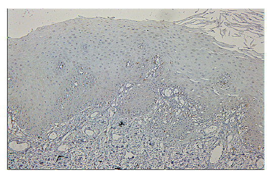 The expression of RUNX3 in normal oral mucosa.