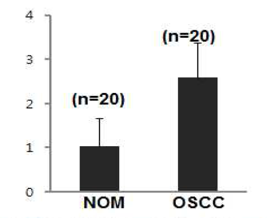 The difference of RUNX3 protein expression between normal oral mucosa and oral squamous cell carcinoma.