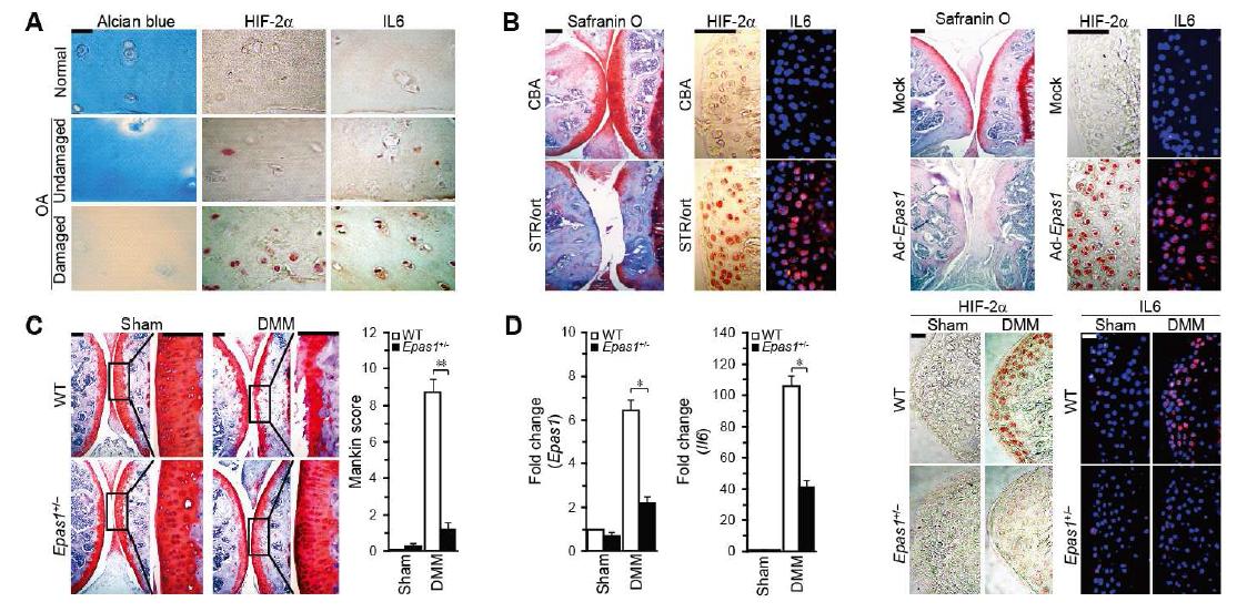 IL6 is up-regulated in OA cartilage.