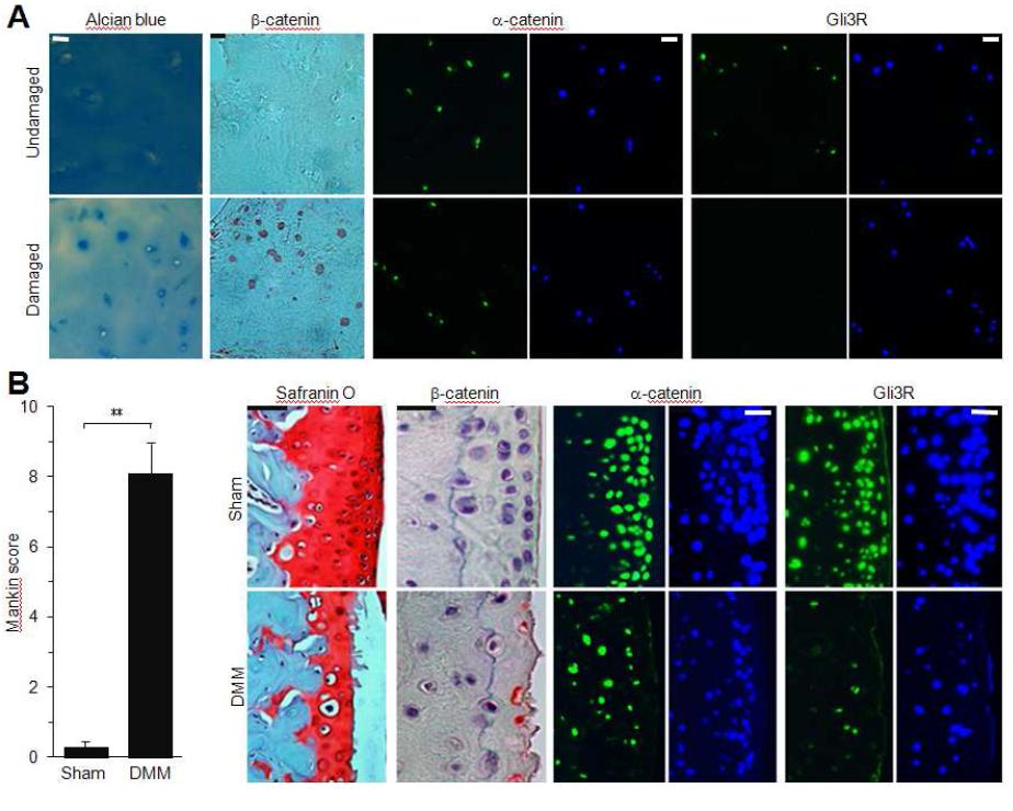 Increase of b-catenin and decrease of a-catenin and Gli3 inexperimental OA cartilage.