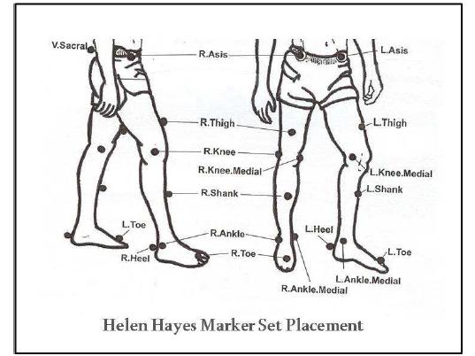 Helen Hayes Marker 시스템