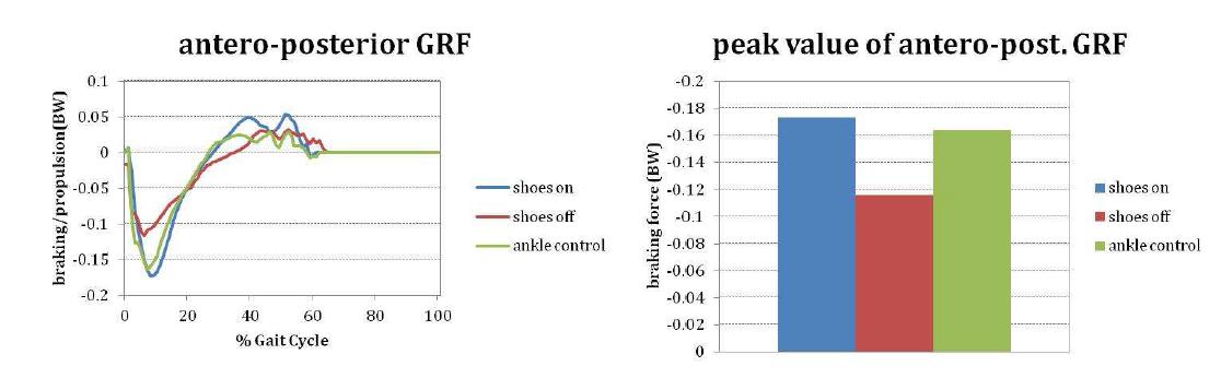 보행 중 전후 지면반발력 및 전후 지면반발력 후진력의 최곳값 차이 비교