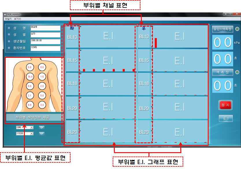 시제품 GUI 홍반지수(E.I.) 측정 그래프