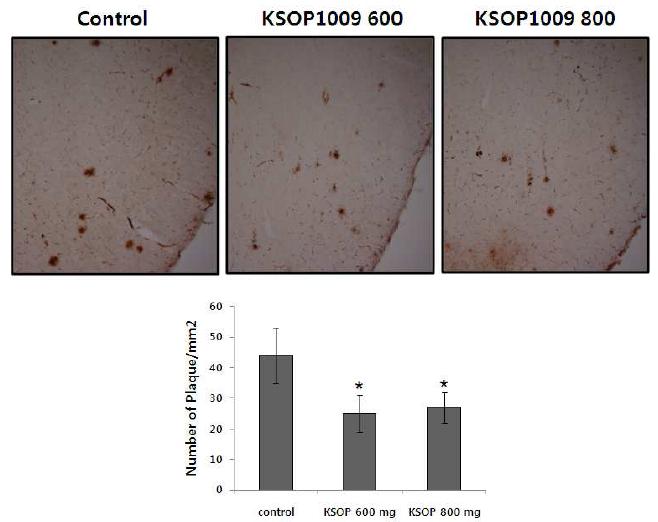 치매 동물 모델에서 아밀로이드 베타 plaque 형성