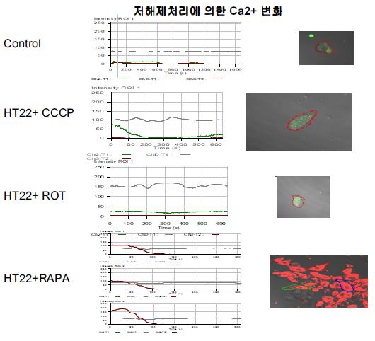 해마신경세포에서의 Aβ oligomer/ApoE siRNA를 처리시 수종의 저해제에 의한 미 콘드리아의 fragment 생성과 칼슘의 변화관계