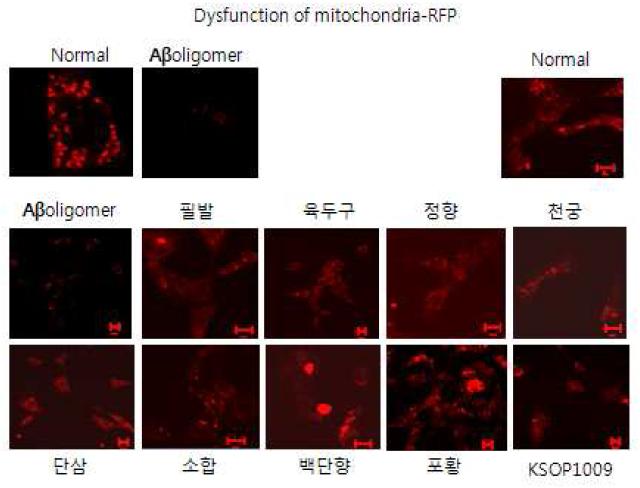 KSOP1009에 의해 미토콘드리아의 형태적 변화