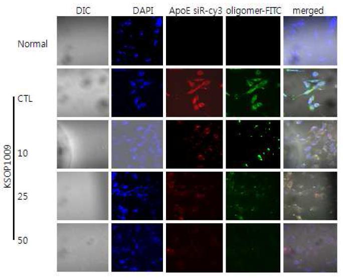 KSOP1009에 의해 oligomeric Aβ-FITC와 ApoE siRNA세포내 독성억제효과