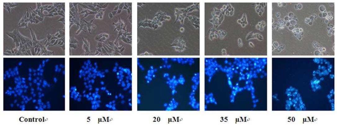 Morphological change of MCF-7 cells observed under an inverted phase contrast microscope (400 X).