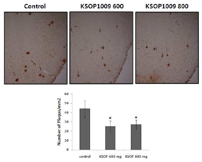 치매 동물 모델에서 아밀로이드 베타 plaque 형성