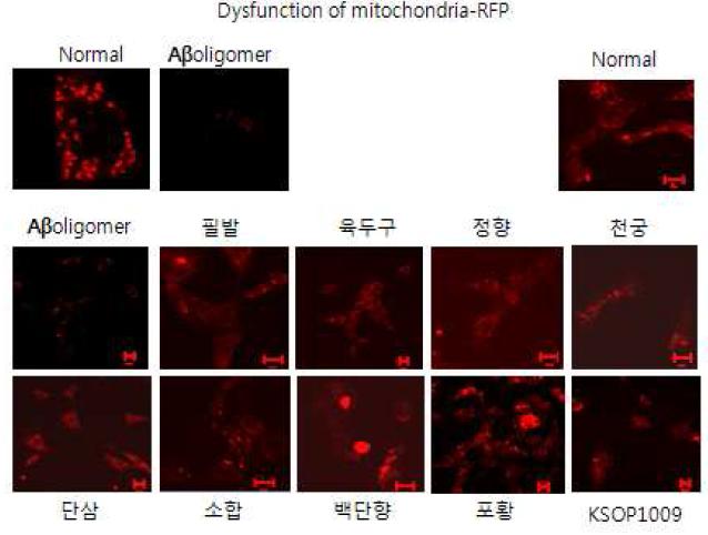 KSOP1009에 의해 미토콘드리아의 형태적 변화