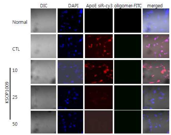 KSOP1009에 의해 ApoE siRNA세포내 독성억제효과