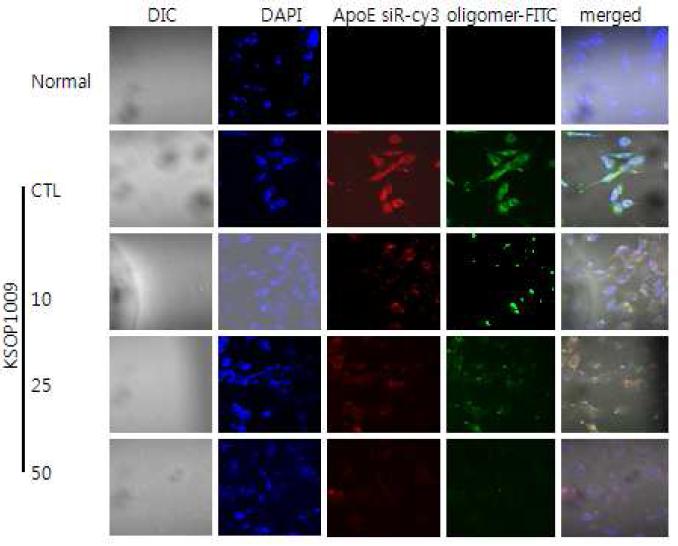 KSOP1009에 의해 oligomeric Aβ-FITC와 ApoE siRNA세포내 독성억제효과