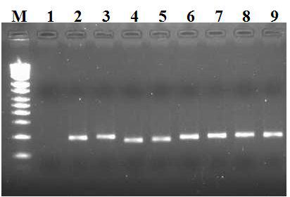 16S rRNA, 18S 혹은 28S universal primer로 증폭한 PCR product.