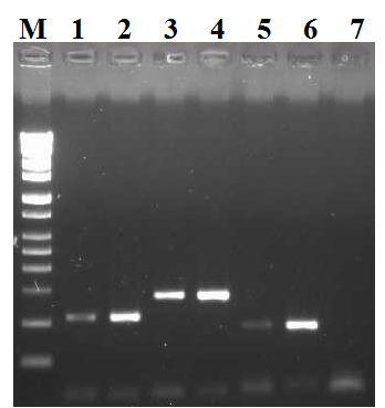 ChuA, YjaA, Tsp.E4.C2 specific primer로 증폭한 PCR product