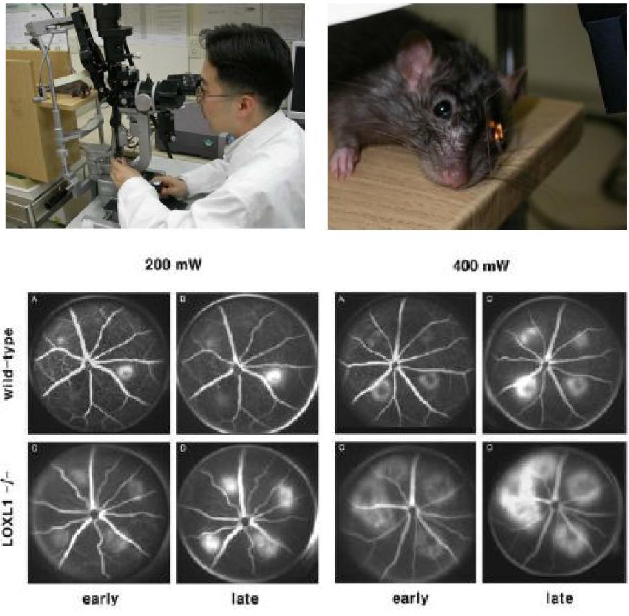 Laser-induced CNV model 제작