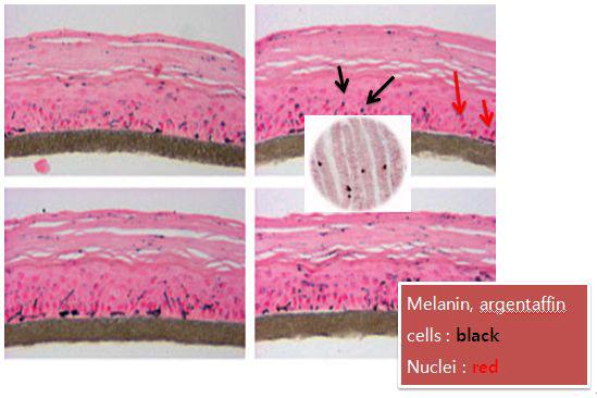 조직학적에서 본 멜라닌 형성세포 과정