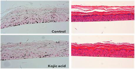 Control (D.W) & 1% Kojic acid