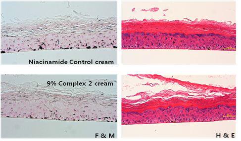 Control (niacinamide) & Complex #2 9% solution