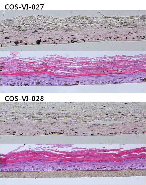 COS-VI-027과 COS-VI-028을 처리한조직의 단면 (위 : F&M염색, 아래 : H&E염색)
