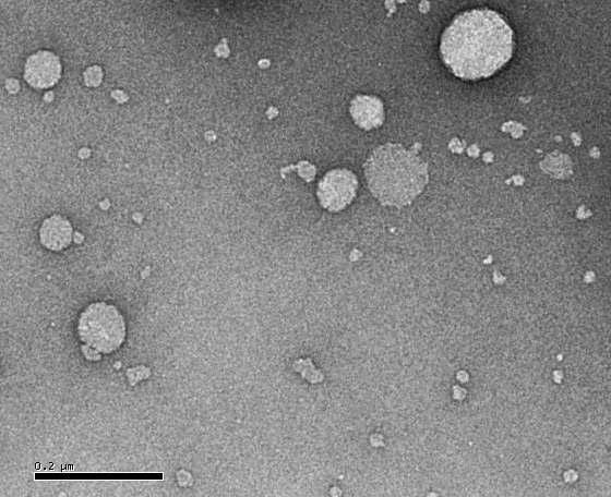 Transmission electron microscopy image of octacosanol nanoemulsion produced by microfluidizer at 30,000 psi and 2 cycles