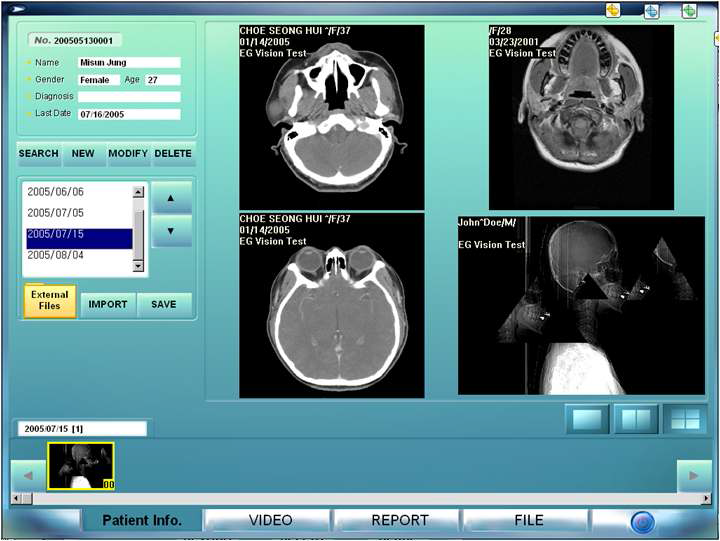 X-ray 영상을 이용한 카메라와 사진을 프로그램