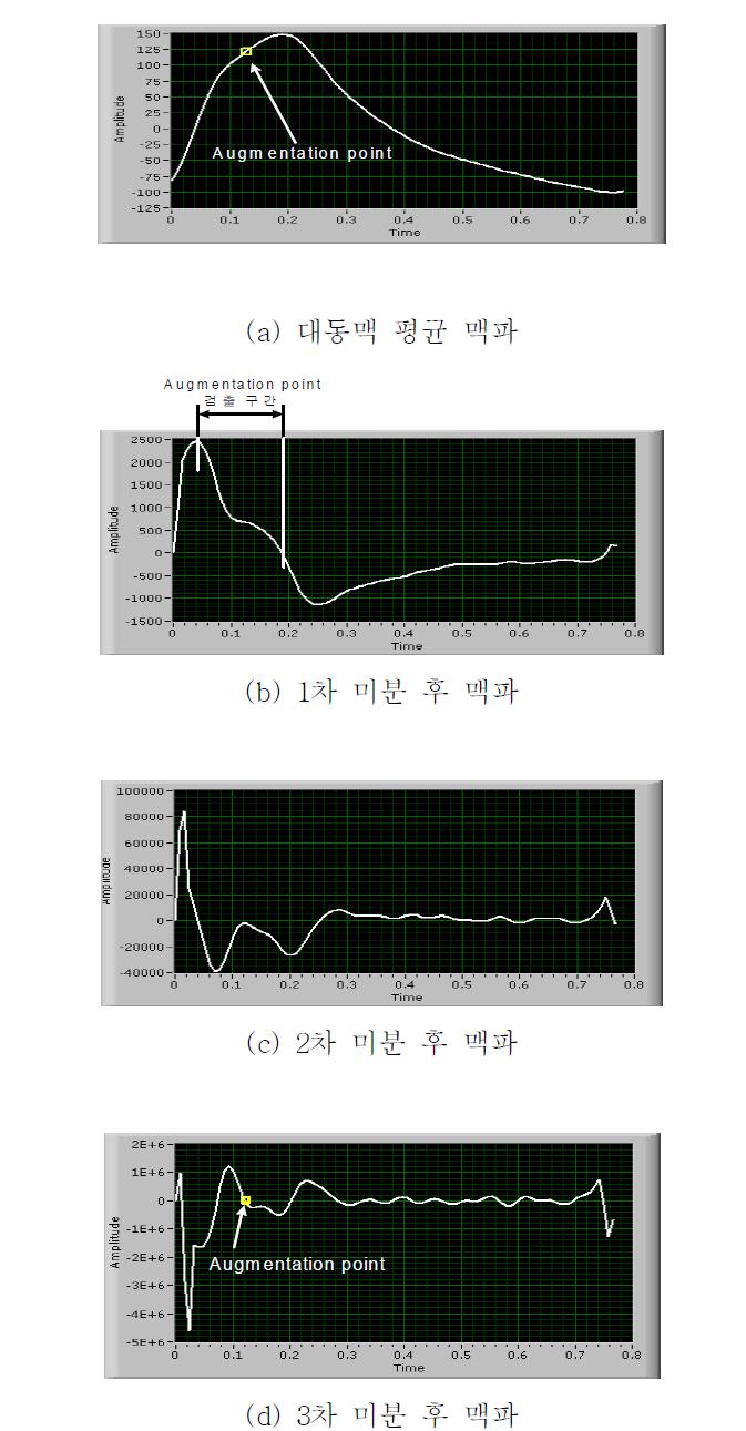 3차 미분을 통한 증강점 검출의 예