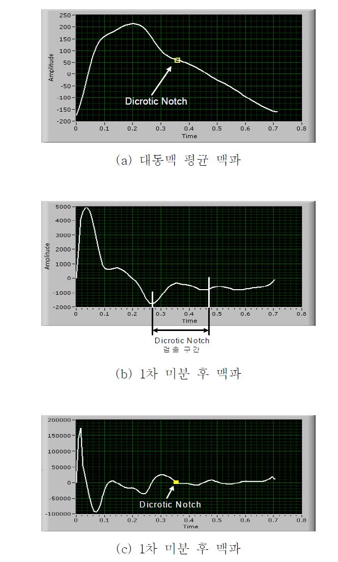 2차 미분을 통한 절흔점 검출