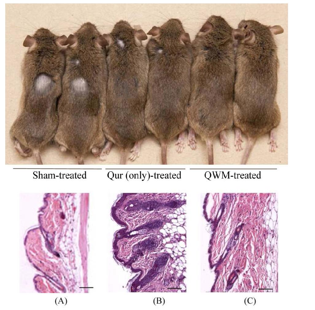 Gross phenotype(upper pannel) and histology (down pannel, A, B, C) of the Quercetin-WPC micropaticle (QWM) on hair regrowth in C3H/HeJ mice with alopecia areata. Shown are C3H/HeJ mice with heat-induced alopecia before and after 6 weeks of control [sham treated, (A)], quercetin only [Qur only treated(B)] and quercetin encapsulated with whey protein [OWM treated (C)] treatments.