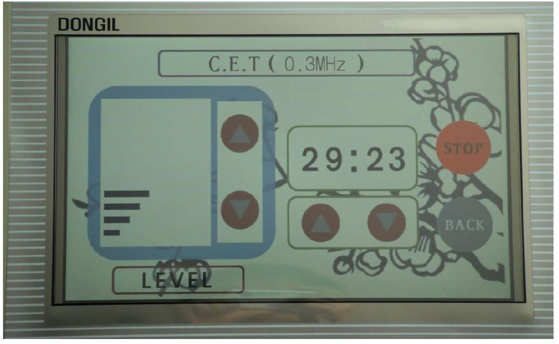 구현된 CET 시술 화면